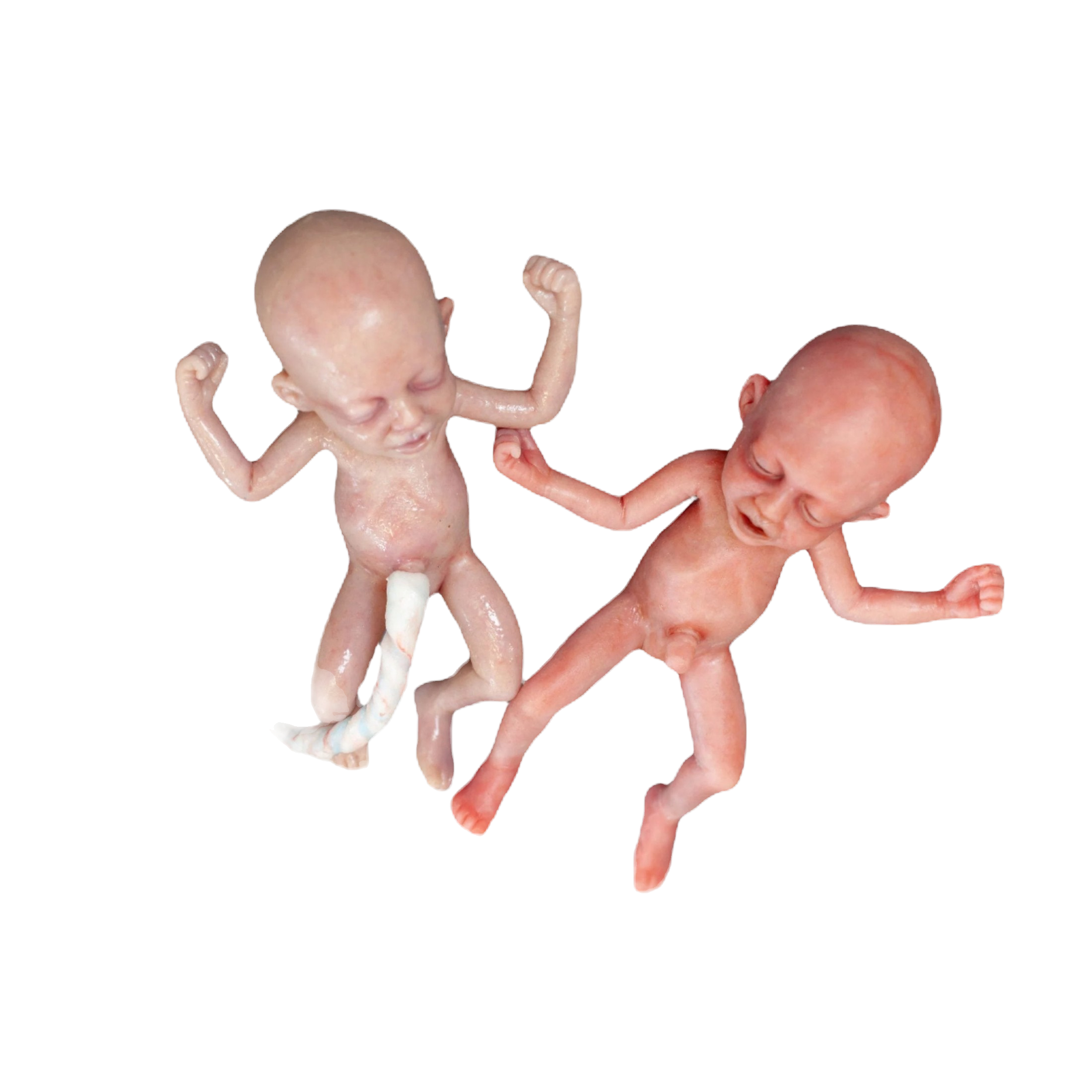 ADVANCED PRE-TERM
28 WEEKS OLD